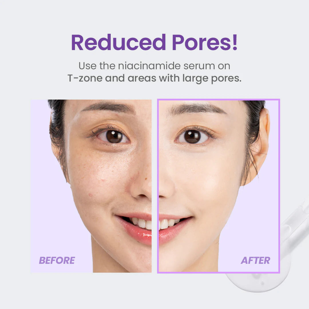 Niacinamide 20% Serum
