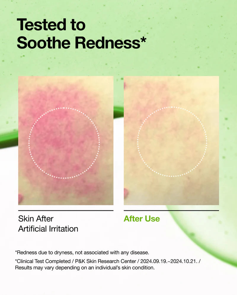 Azelaic Acid 10% Hyaluron Redness Soothing Serum